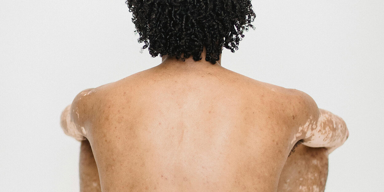 pexels-armin-rimoldi-5301553